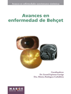 cover image of Avances en enfermedad de Behçet